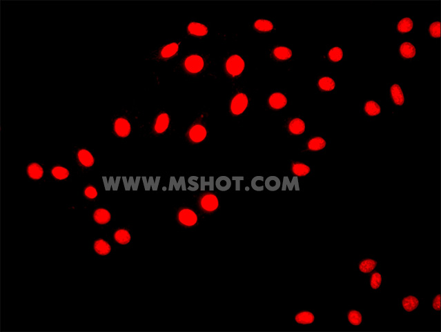 倒置熒光顯微鏡 MF53拍攝的顯微鏡圖片-2